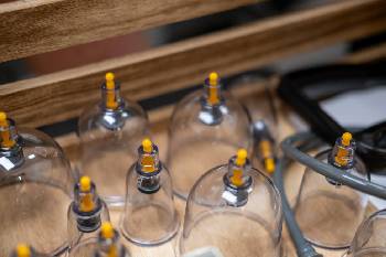 Cupping Therapy